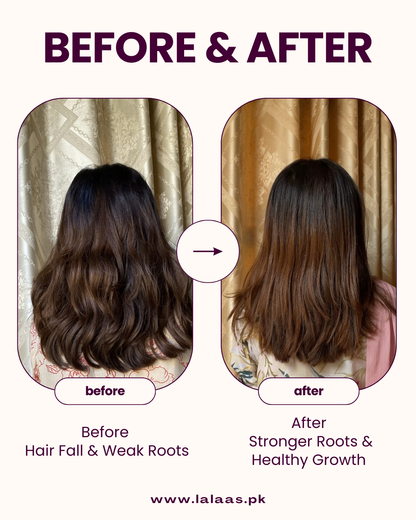 LALAAS Ultimate 20+ Herbal Hair Revival Oil